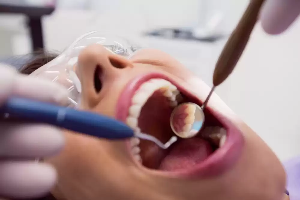 Dental Restorations (Aesthetic Fillings)